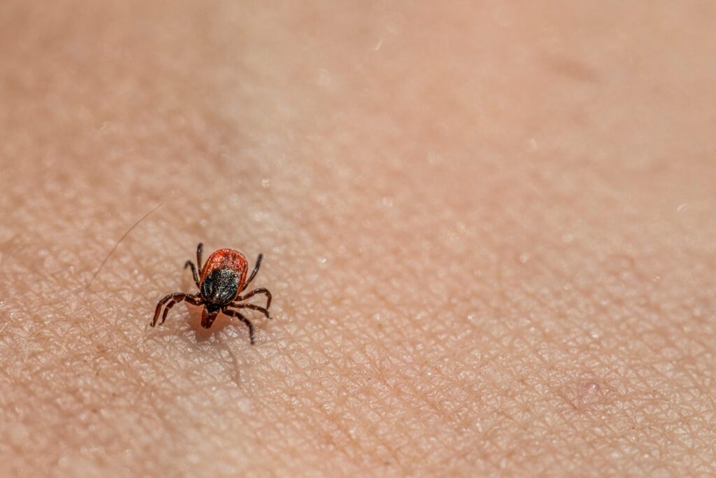 A tick on the skin of a person
