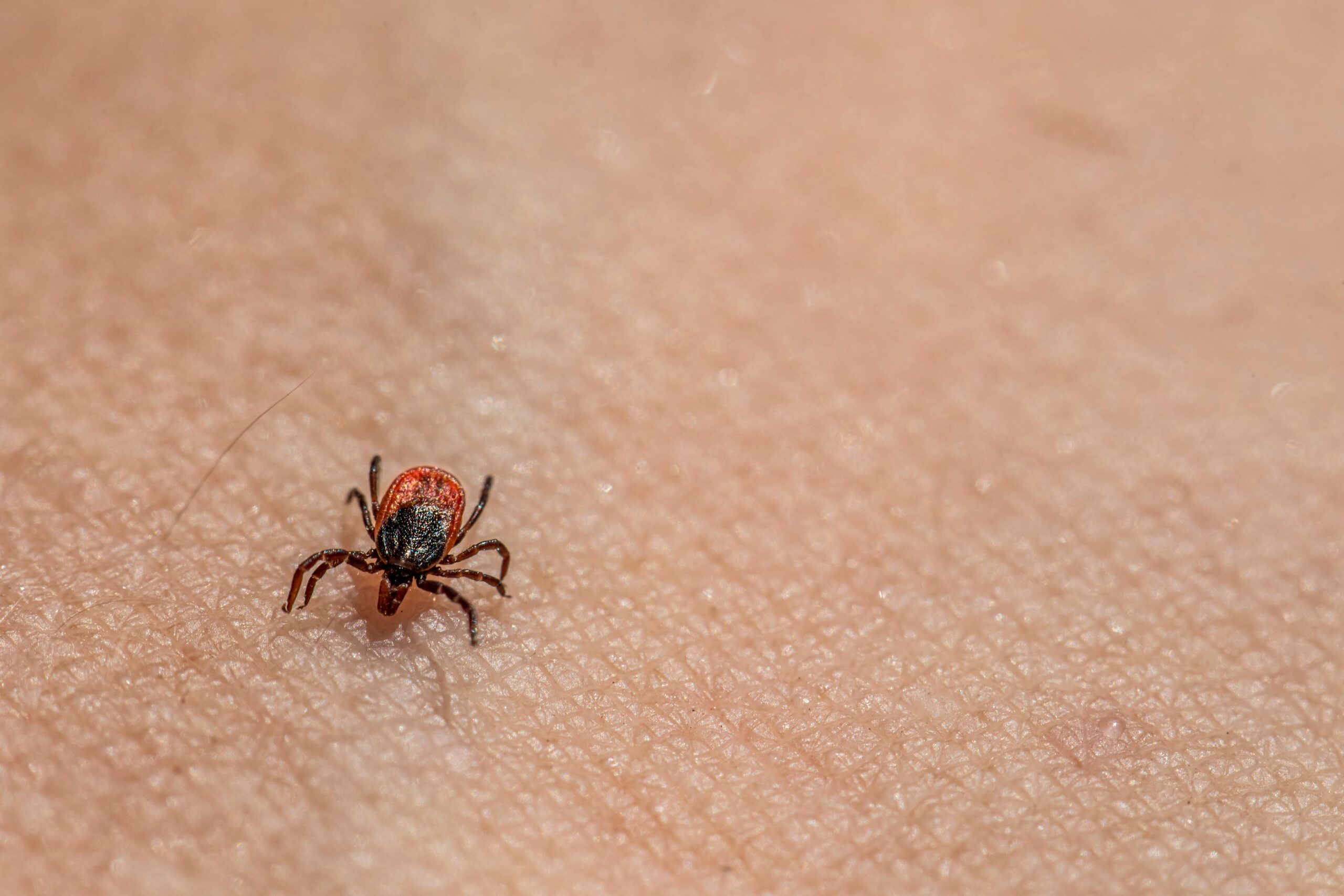 A tick on the skin of a person